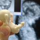 Illustration for article titled 3D sonograms let blind expectant parents see their babies